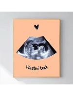 Personalizovaný magický fotoobraz v rámu - 40x50 - ultrazvuk Personalizovaný magický fotoobraz v rámu - 40x50 - ultrazvuk