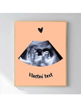 Personalizovaný magický fotoobraz v rámu - 40x50 - ultrazvuk Personalizovaný magický fotoobraz v rámu - 40x50 - ultrazvuk