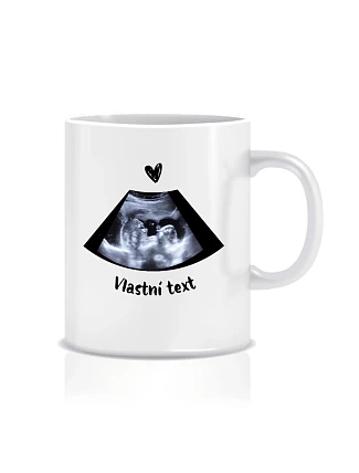 Personalizovaný klasický bílý keramický hrníček 300 ml s ultrazvukem Personalizovaný klasický bílý keramický hrníček 300 ml s ultrazvukem