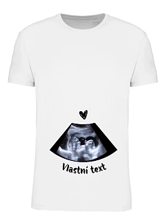 Personalizované dámské tričko - ultrazvuk