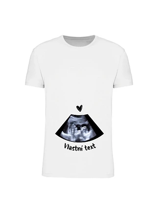 Personalizované dámské tričko - ultrazvuk Personalizované dámské tričko - ultrazvuk