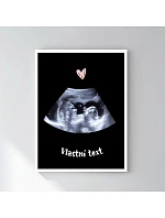 Personalizovaný magický fotoobraz v rámu - 30x40 - ultrazvuk Personalizovaný magický fotoobraz v rámu - 30x40 - ultrazvuk