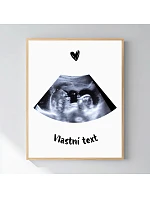 Personalizovaný magický fotoobraz v rámu - 50x70 - ultrazvuk Personalizovaný magický fotoobraz v rámu - 50x70 - ultrazvuk