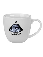 Personalizovaný keramický hrníček 400 ml s ultrazvukem Personalizovaný keramický hrníček 400 ml s ultrazvukem