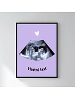 Personalizovaný magický fotoobraz v rámu - 30x40 - ultrazvuk Personalizovaný magický fotoobraz v rámu - 30x40 - ultrazvuk
