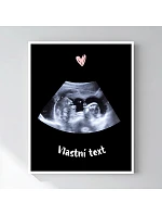 Personalizovaný magický fotoobraz v rámu - 40x50 - ultrazvuk Personalizovaný magický fotoobraz v rámu - 40x50 - ultrazvuk