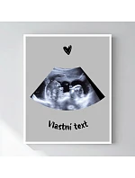 Personalizovaný magický fotoobraz v rámu - 50x70 - ultrazvuk Personalizovaný magický fotoobraz v rámu - 50x70 - ultrazvuk