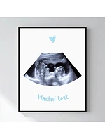 Personalizovaný magický fotoobraz v rámu - 40x50 - ultrazvuk Personalizovaný magický fotoobraz v rámu - 40x50 - ultrazvuk