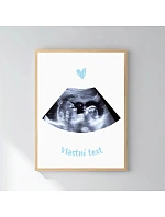 Personalizovaný magický fotoobraz v rámu - 30x40 - ultrazvuk Personalizovaný magický fotoobraz v rámu - 30x40 - ultrazvuk