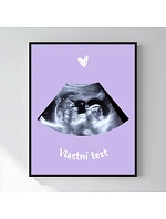 Personalizovaný magický fotoobraz v rámu - 50x70 - ultrazvuk Personalizovaný magický fotoobraz v rámu - 50x70 - ultrazvuk