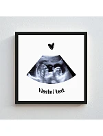 Personalizovaný magický fotoobraz v rámu - čtverec 20x20 - ultrazvuk Personalizovaný magický fotoobraz v rámu - čtverec 20x20 - ultrazvuk