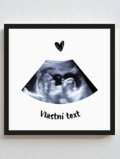 Personalizovaný magický fotoobraz v rámu - čtverec 20x20 - ultrazvuk