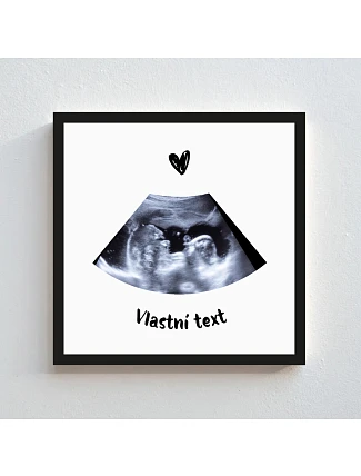 Personalizovaný magický fotoobraz v rámu - čtverec 20x20 - ultrazvuk Personalizovaný magický fotoobraz v rámu - čtverec 20x20 - ultrazvuk